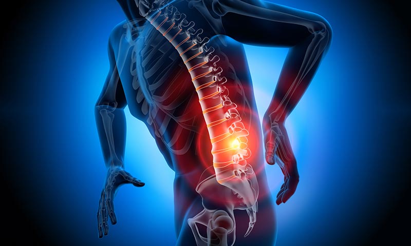 espondilolise e espondilolistese